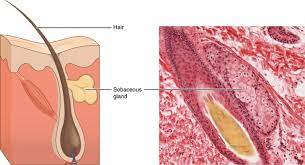 Sebaceous Gland Definition And Function Biology Dictionary