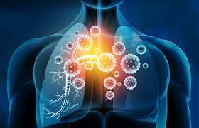 Vaping Can Damage Vital Immune System Cells Asthma Canada