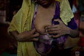 Out of the shadows: Rohingya rape survivors' babies arrive — AP Photos