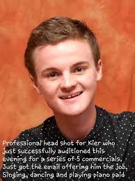 I have severe eczema so I basically shed like a lizard LMAO but look at the  little man😭