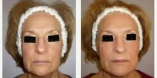 Leslie Pickens, MD, Board Certified Emergency Medicine Physician