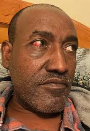 ከነጉዳቴ ወደ መኖሪያዬ ገብቻለሁ! #Ethiopia