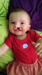 Pomoc pre Nelku a jej rodinu