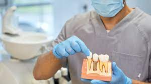 Are Dental Implants Safe? Discover the Undeniable Truth