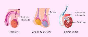 Una patada en los testículos produce infertilidad masculina?