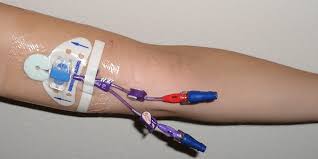 Image result for Peripheral IV Access