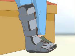 Mit Einem Gebrochenen Fuss Trainieren 12 Schritte Mit Bildern Wikihow
