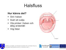 Schweizer radio und fernsehen, zur startseite. Halsfluss Och Oroninflammation