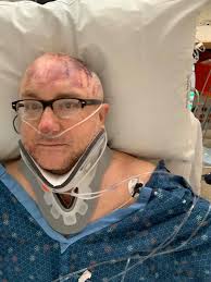 My dear friend Joel was just in a very serious mountain bike accident. He  was a frequent rider of Santos and surrounding trails and just an amazing  all around human. He and