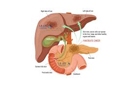 Image result for pancreas location
