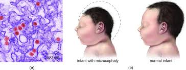 Acellular Diseases Of The Nervous System Microbiology