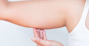 It appears to be more common in women than in men. How To Get Rid Of Bat Wings The Best Exercises