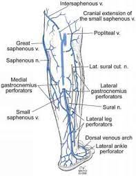 Anatomy of ilioinguinal and iliohypogastric nerves in relation to trocar placement and low transverse incisions. Lower Extremity Vein Anatomy Gsv Leg Vein Anatomy Vein Surgery Anatomy