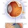 Retina problems from www.mayoclinic.org