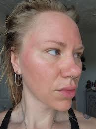 I'm having trouble finding a list of BII approved surgeons… Any area is  fine. Is there a comprehensive list posted somewhere? I've searched around  a bit and can't find it. Any help