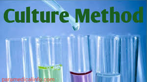 Maybe you would like to learn more about one of these? Different Types Of Culture Methods