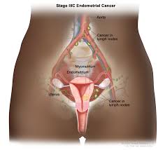 Image result for uterus