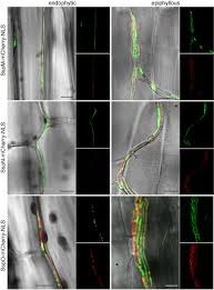 Know the current nps interest rates offered by the indian government. Analysis Of Epichloe Festucae Small Secreted Proteins In The Interaction With Lolium Perenne Biorxiv