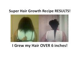 Wash the scalp and hair the next morning using emu tracks ultra. New Super Hair Growth Recipe Emu Oil Castor Oil Youtube