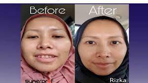 Bus station tulum ruins is 5 mi from o'tulum, while tulum bus station is 6.8 mi from the property. Black Daily Eliminating Female Rekomendasi Eye Creams Spots Whatsapp About Trulum By Trulumasia Com The Sk In 2020 Wrinkle Solution Diy Eye Cream Tighter Skin