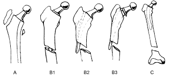 Rankings, courses, admissions, tuition fee, cost of attendance & scholarships. Https Epub Uni Regensburg De 25870 1 Dissertation Evangelos Georgomanos Pdf