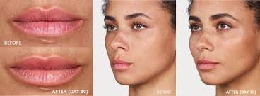 4 Treatments To Rejuvenate Your Smile Before Holiday Season