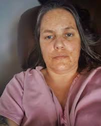 Fundraiser by Morgan Spielman : Help Morgan with renal autotransplant and  medical