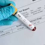  Task force recommendation 'step toward harmonizing' prostate cancer screening approaches