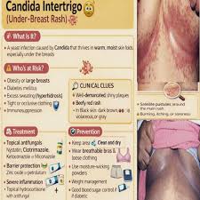 Image result for Intertrigo under breasts