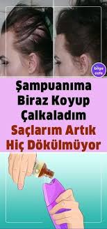 Sac Dokulmesini Hayatinizdan Komple Cikaran Bu Tarifi Mutlaka Denemelisiniz Sac Dokulmesi Saglik Saglikli Sac