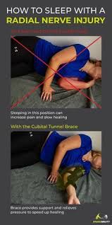 Pin On Radial Nerve