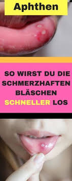 Pin Auf Gesundheit