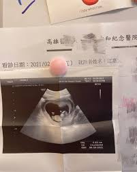 See more of 罔腰尬鳳梨 on facebook. 0an3l3biij1bum