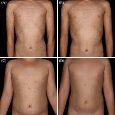 Image result for Pleiotaxis