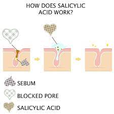 We asked two top dermatologists and a cosmetic chemist to break down how salicylic salicylic acid is a beta hydroxy acid, which makes it great at attacking pimples. Bravura London Salicylic Acid Is Such An Amazing Facebook