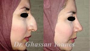 Dr Ghassan Younes...