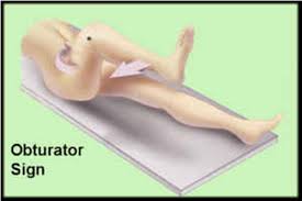 Image result for Obturator Sign