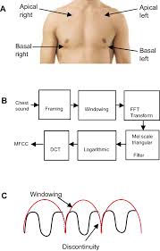 A Chest Sound Auscultation And Recording Areas B Mfcc Feature Download Scientific Diagram