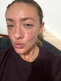 Woman, 66, Lost 110 Pounds and Got a Dramatic Facelift So Shocking, the  Internet Thought It Was Fake (Exclusive)