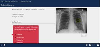 Standard frontal chest radiograph (roentgenogram) — upright; Teaching Medical Students How To Interpret Chest X Rays The Design An Amep