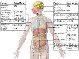 The normal range of cancer markers is less than 30 units/ml. Cisn Tumor Markers