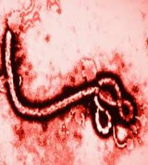 El virus de marburgo causa en el ser humano una fiebre hemorrágica grave. Desarrollan Un Tratamiento Contra El Virus De Marburgo El Primo Del Ebola Ecodiario Es