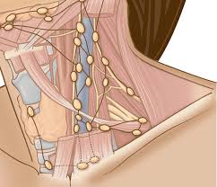 Having cancer cells in the lymph nodes under your arm is associated with an increased risk of the cancer spreading. Metastatic Lymph Nodes Thanc Guide