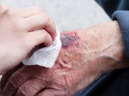 Finally, treat the graze with a plaster. 5 Reasons Why Wounds Won T Heal Assessing Non Healing Wounds