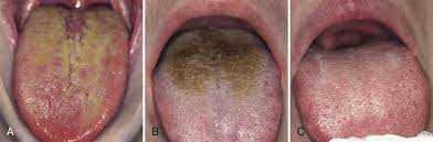 Image result for Malouetia mildbraedii