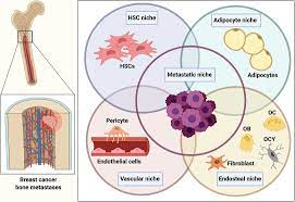 Frontiers The Endosteal Niche In Breast Cancer Bone Metastasis Oncology