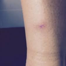 Wunde Doccheck Flexikon