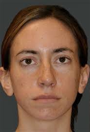 Swan Contestant Kelly Becker