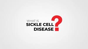 Symptoms of sickle cell anemia include bacterial infections, arthritis, leg ulcers, fatigue, and lung and heart injury. What Is Sickle Cell Disease