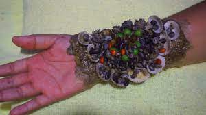 Wah Wah I Can T Believable This Dandruff With Worms 673 Youtube